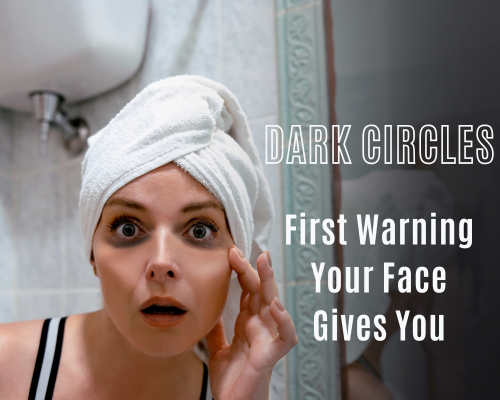 Dark Circles:  Your Body’s First Passive-Aggressive Cry for Help