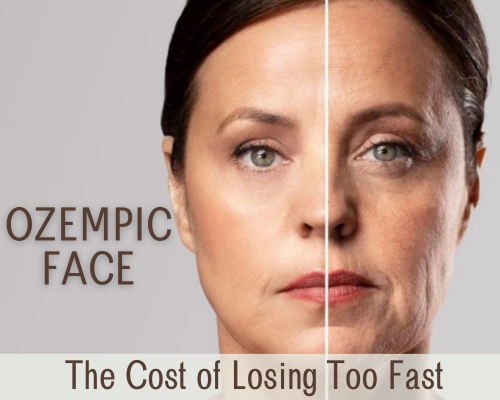 The Ozempic Face: Is Rapid Weight Loss Harming Your Collagen?